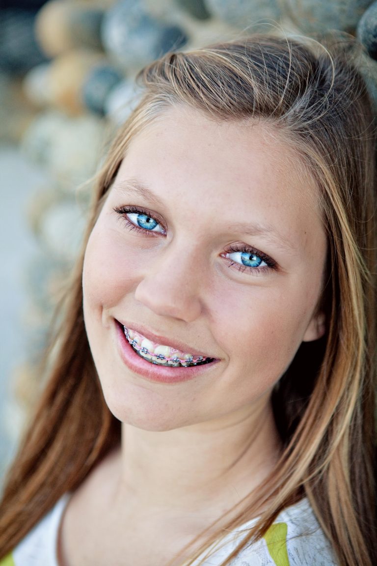 Close-up of a smiling teenage girl with metal braces with pink and purple bands, Hulse Orthodontics, Carlsbad CA