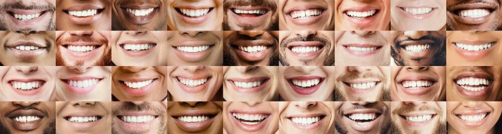 Teeth Shaving for Invisalign: What to Expect with Interproximal Reduction