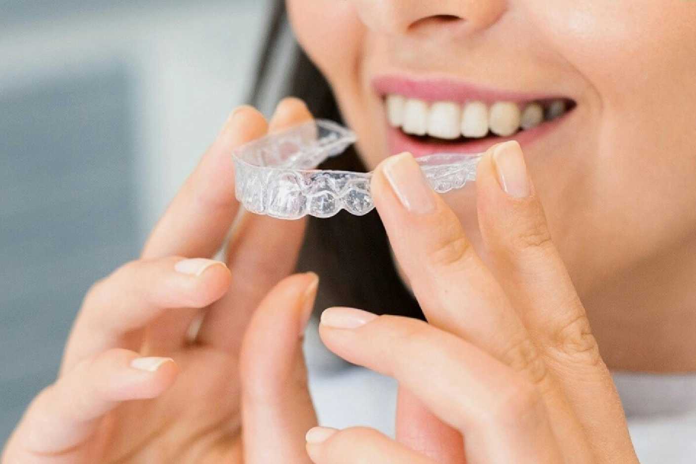 Invisalign clear aligners
